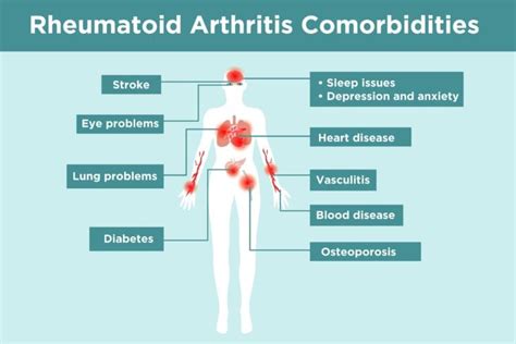 Rheumatoid Arthritis Complications: What RA Patients Need to Know