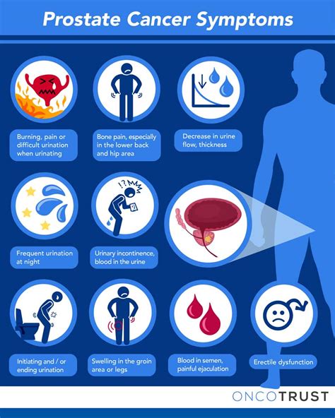 Prostate Cancer Symptoms Causes Treatment Vector Icons | The Best Porn Website