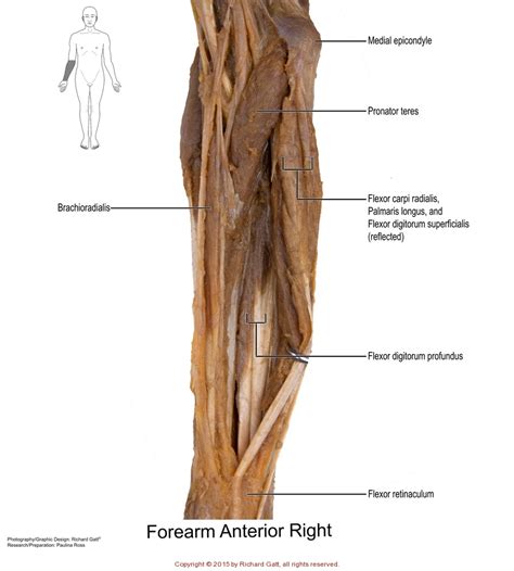 Appendicular Muscles Labeled