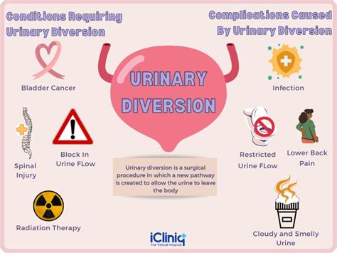 Continent Urinary Diversion