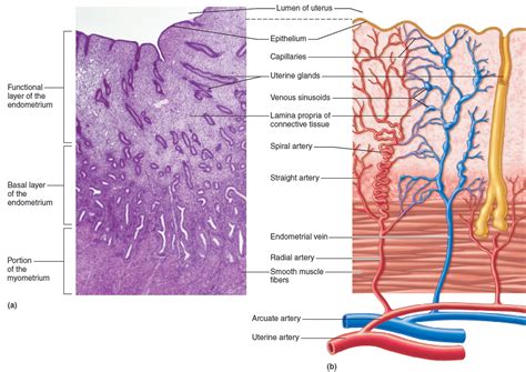 Endometrial hyperplasia, types, causes, symptoms, diagnosis, treatment & prognosis