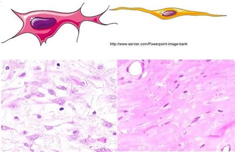 fibroblast vs fibrocyte histology - Google Search | Tissus conjonctif ...