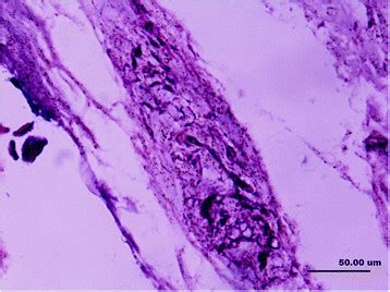 A longitudinal section of a Golgi tendon organ (type III),... | Download Scientific Diagram