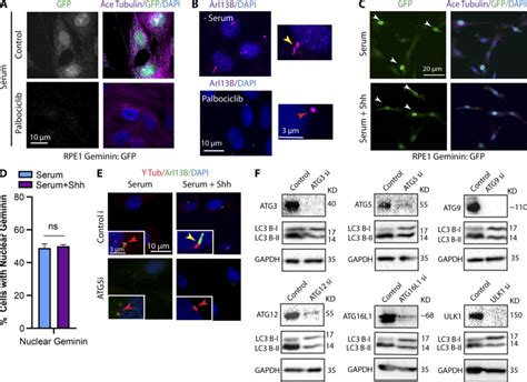 Confirmation of Palbociclib activity and depletion ofautophagy proteins... | Download Scientific ...