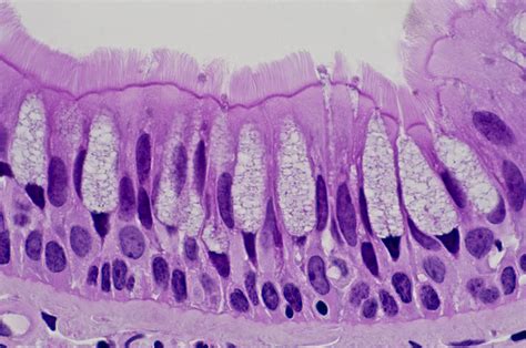 Definition Of Pseudostratified Epithelial Tissue - DEFINITIONXC