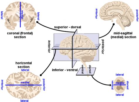 Human Brain: Directions, cross-sections and divisions | Anatomia del cerebro humano, Cerebro ...