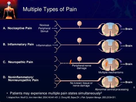 Nociceptive Pain | ELIM RHEUMATIC CENTRE