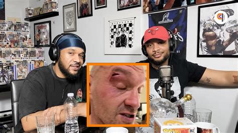 Tyson Fury FAKES "Accidental" Cut Above Eye During Sparring To AVOID Oleksandr Usyk? - YouTube