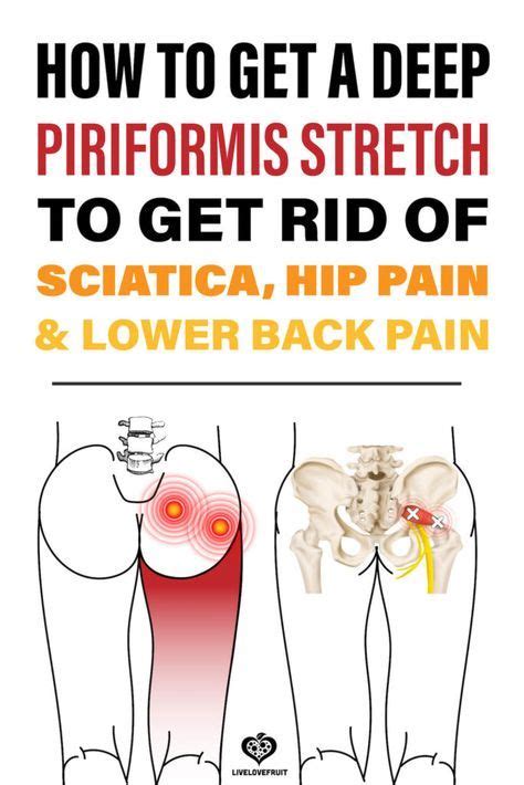 Sciatica, hip pain and lower back exercises...