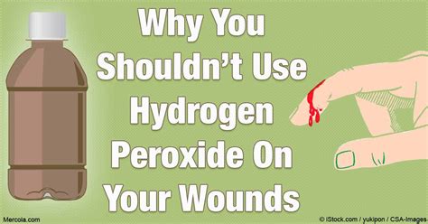 Hydrogen Peroxide & Wounds | Ramsey, NJ Patch