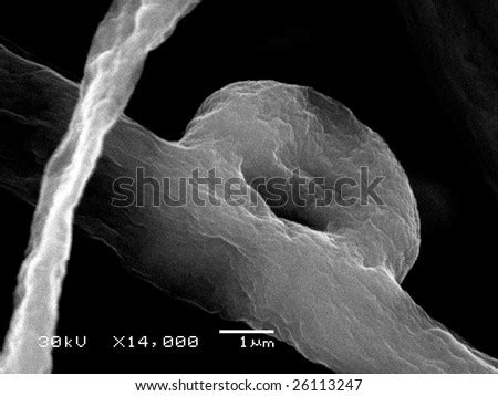 Original Scanning Electron Microscope Images Of Fungi Mycelium And ...