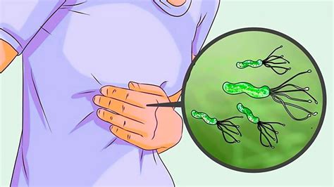 6 Proven Natural Remedies for H. Pylori - YouTube