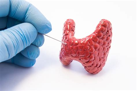 Fine Needle Aspiration – Thyroid UK