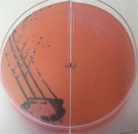 Xylose lysine deoxycholate (XLD) agar: Composition Preparation, Results and Uses - microbeonline