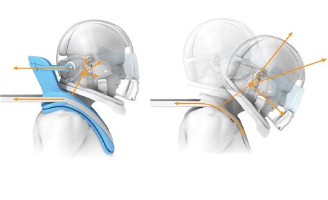 The Physics Of: How the HANS Device Saves Lives - Feature - Car and Driver