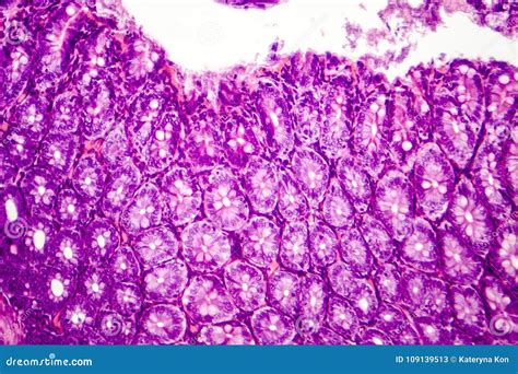 Histology of Human Appendix, Micrograph Showing Crypts of Lieberkuhn Stock Image - Image of ...