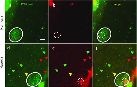 EtBr staining granules do not overlap with SYBR gold staining. a-f N2 ...