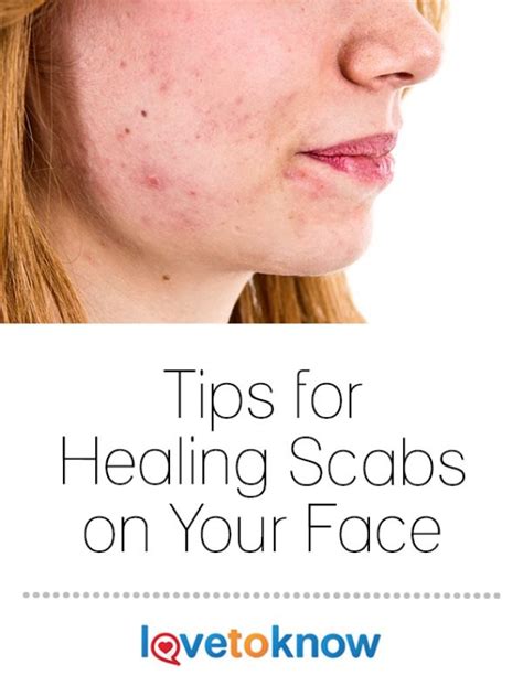 Healing Scabs on Your Face | LoveToKnow Health & Wellness | Scab healing, Face healing, Scab on face