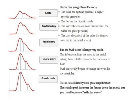 EMCrit 210.1 - Arterial Lines (Part 1)