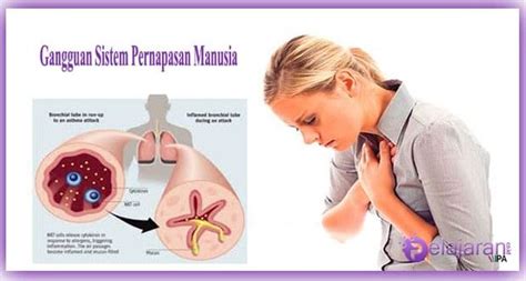 9 Gangguan Sistem Pernapasan Pada Manusia yang Harus Anda Ketahui - Mediasiana.com - Media ...