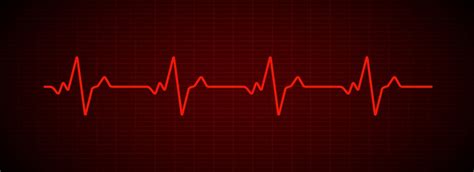 What is Sinus Arrhythmia? Symptoms, Causes & Treatment