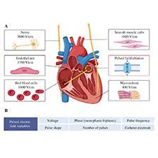 Advances in the Application of Pulsed Field Ablation for Arrhythmia ...