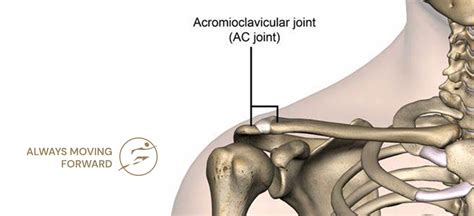 AC Joint Repair Treatment, Acromioclavicular Joint Surgery in Indore, M.P.