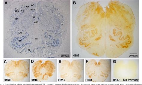 Figure 1 from Mapping the calcitonin receptor in human brain stem. | Semantic Scholar