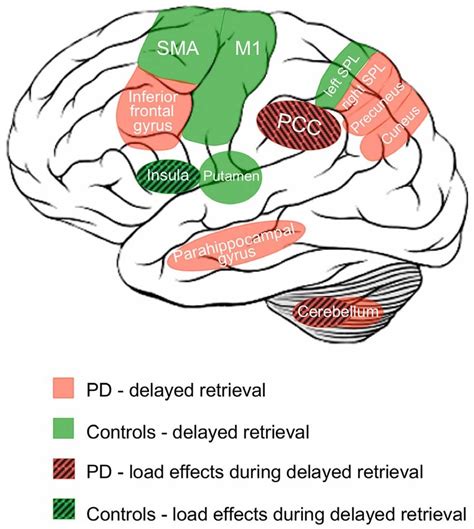 Schematic overview of working-memory related activation patterns in PD... | Download Scientific ...