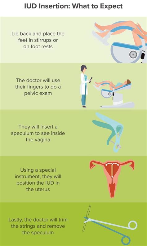 What to expect during IUD insertion - Vistasol Medical Group