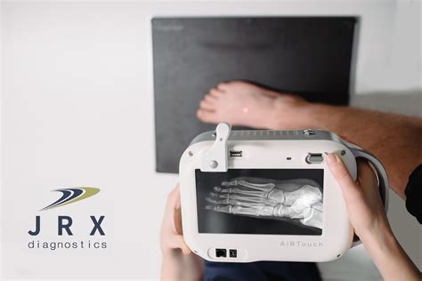 Buy Podiatry Digital X Ray Machines - JRX Diagnostics LLC