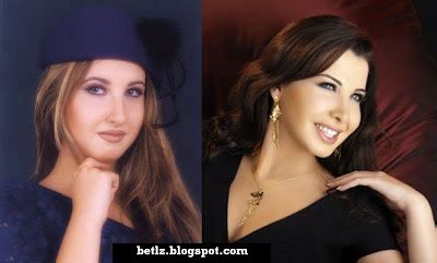 Arabic Glory: ARABIC DIVA'S : plastic surgery before and after