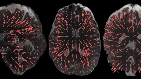 New 3D MRI Shows the Brain in Detail We've Never Seen Before