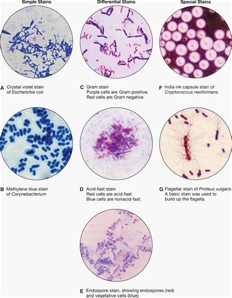 Gram Stain Results Interpretation - Solved: PART I: GRAM STAIN RESULTS Complete The Following ...