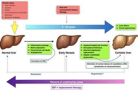 Insulin-Like Growth Factor-1 Deficiency and Cirrhosis Establishment ...