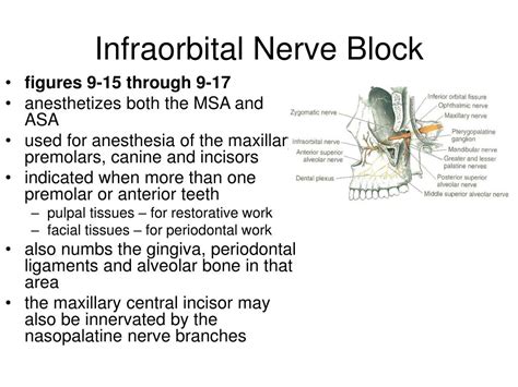 PPT - Local Anesthesia PowerPoint Presentation - ID:193943