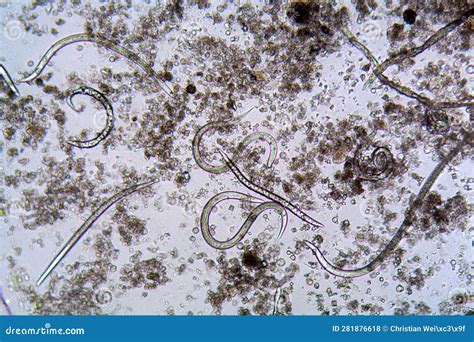 The Nematode Steinernema Feltiae Under the Microscope Stock Photo ...