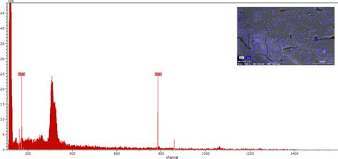 ED-XRF spectrum and SEM images of Co(II)-AXAD-1180 resin | Download Scientific Diagram