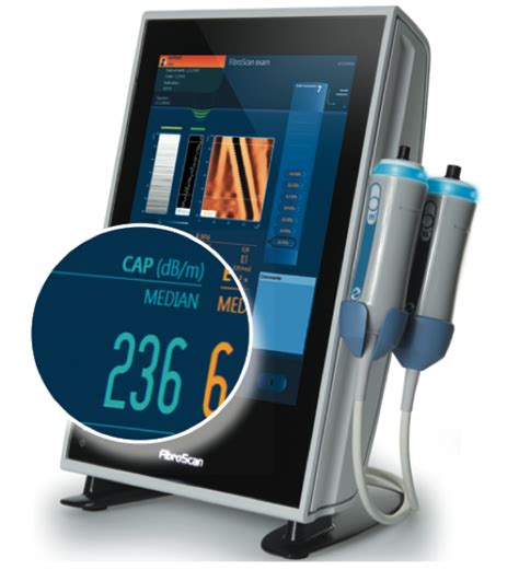 SMART SCAN , Fibroscan, Liver elastography and CAP scan ...