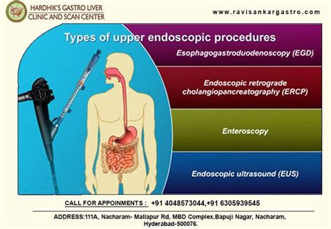 Upper Gi Endoscopy Procedure