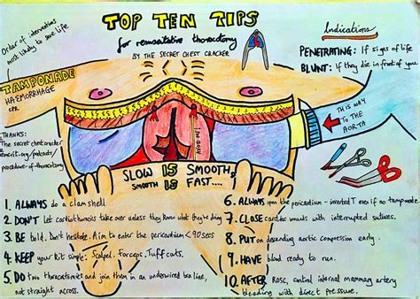 a drawing of top ten things