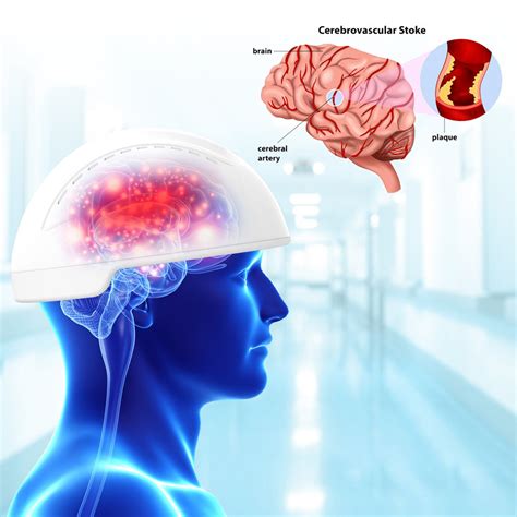 Traumatic Brain Injury Brain Photobiomodulation Devices 810nm Wavelength