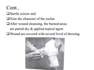 Dressing of burn wound | PPT