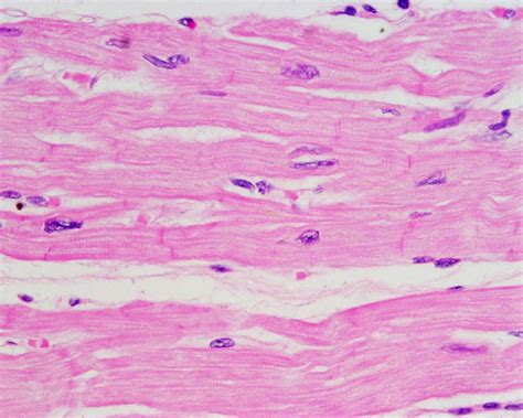 intercalated discs and pacemaker cells are characteristic of ...