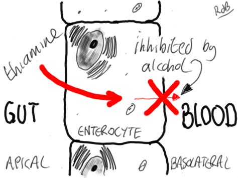 Does Alcohol Affect Thiamine Metabolism?