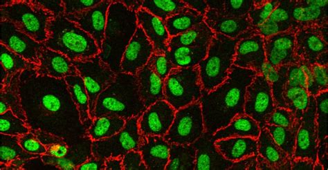 Perform Endothelial Cell Culture for Groundbreaking Experiments - Elveflow