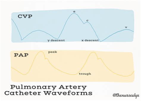 PA Catheter Basics – CriticalCareNow