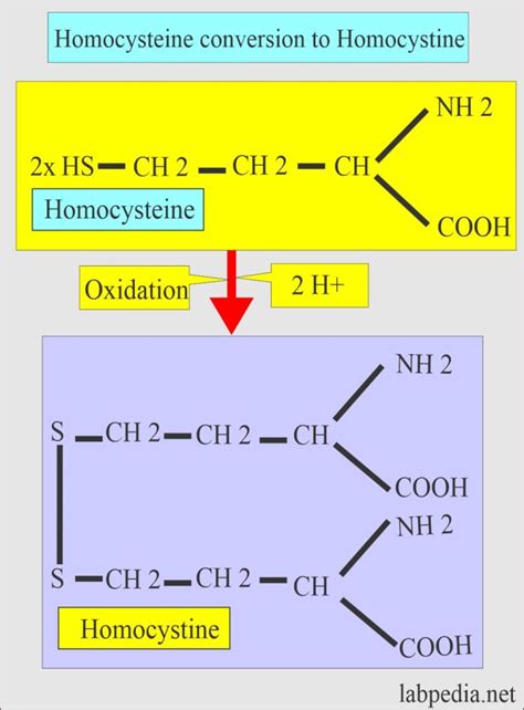 Homocystinuria, Diagnosis and Treatment - Labpedia.net