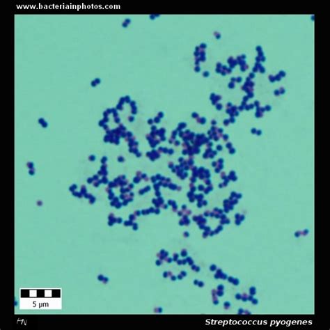 Streptococcus pyogenes under microscope: microscopy of Gram-positive ...