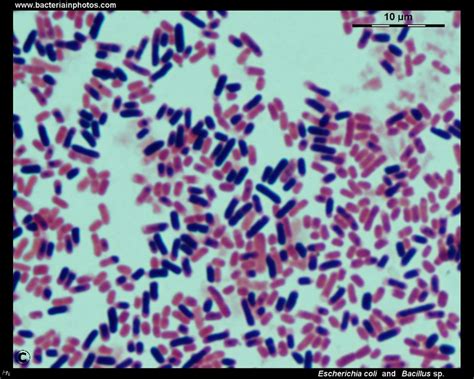 Escherichia coli and Bacillus sp. microscopy